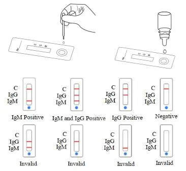 Lateral Flow Toxoplasma Gondii (TOXO) Iggigm Rapid Test Cassette